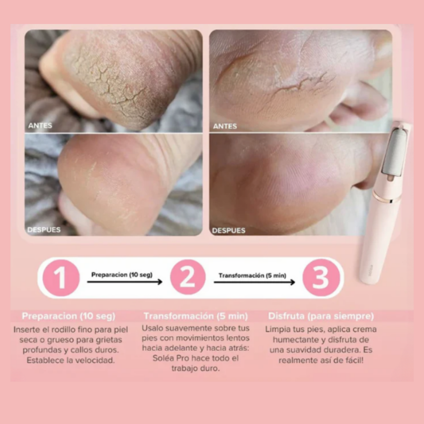LIMASOFT® -Luce unos Pies impecables Sin Esfuerzo