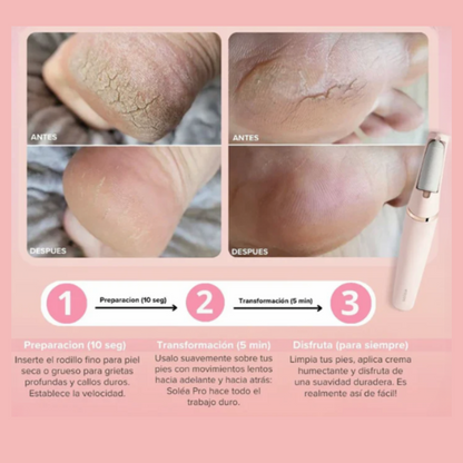 LIMASOFT® -Luce unos Pies impecables Sin Esfuerzo