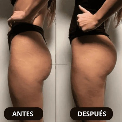 LiftUp Pro - Glúteos Perfectos sin Sentadillas! Rápidos y Efectivos