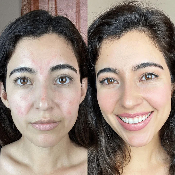 Estela M. | 32 años