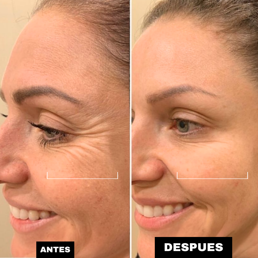 El Ritual de 3 Pasos que Combate Arrugas y Devuelve la Luminosidad a tu Rostro.